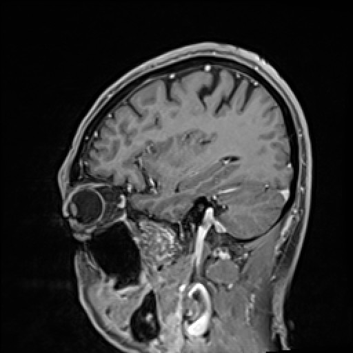 Click on the Serie image to view the images of VILLANUEVA, WILLIAM A.